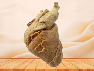 cardiac muscle plastinated specimen