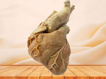 cardiac muscle plastination specimen