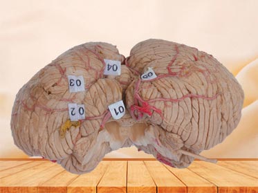 cerebellar artery plastination specimen