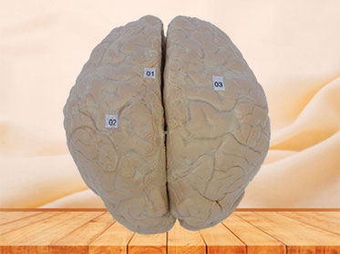 cerebral arachnoid mater