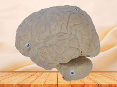 cerebral arachnoid mater plastinated specimen