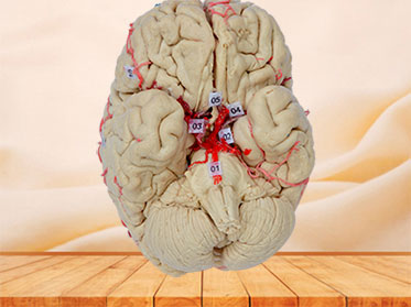 cerebral artery plastinated specimen