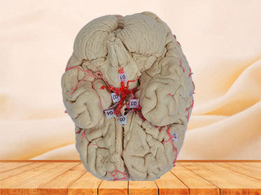 cerebral artery plastination