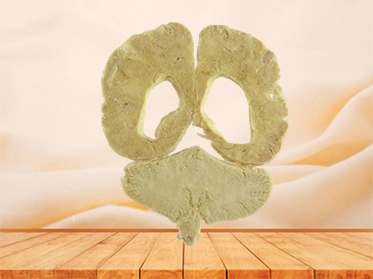 coronal section of brain plastinated specimen