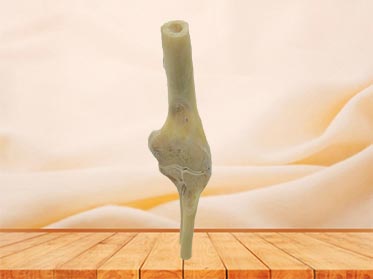 coronal section of elbow joint