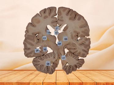coronal section of head plastinated specimen