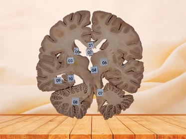 coronal section of head specimen plastination