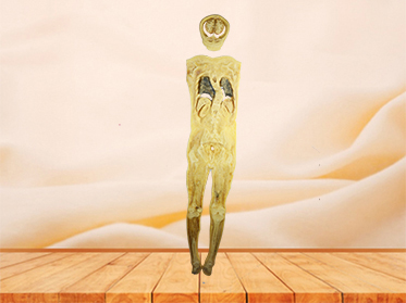 coronal section of human body plastination