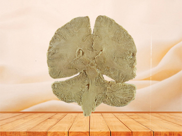 coronal section of human brain