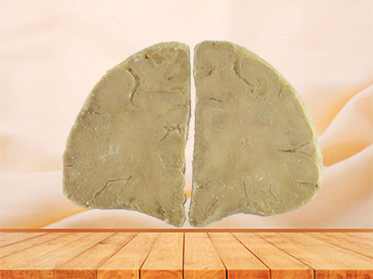 coronal section of human brain for sale