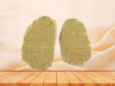 coronal section of human brain plastination