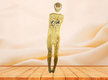coronal section of human specimen