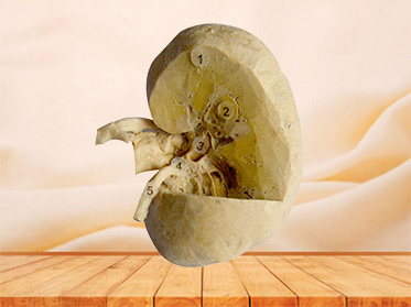 coronal section of kidney 3 quaters plastination