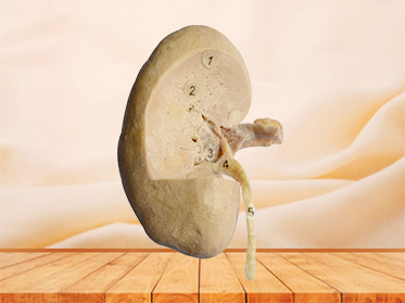 coronal section of kidney 3 quaters plastination specimen
