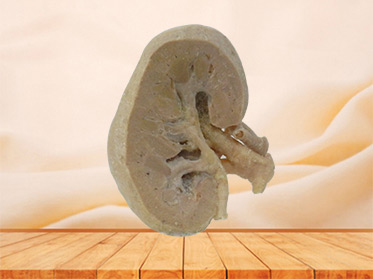 coronal section of kidney anatomic specimen