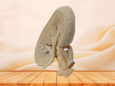 coronal section of kidney human plastinated for sale