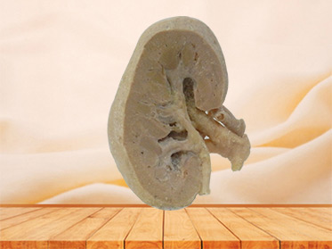 coronal section of kidney human specimen