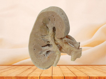 coronal section of kidney plastinted cadavers