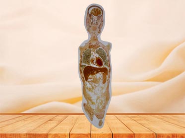 coronal section of whole body embedded specimen