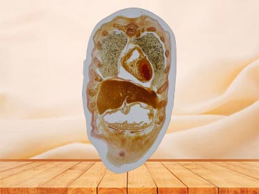 coronal section of whole body embedded specimen for medical university