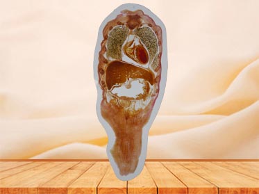coronal section of whole body embedded specimen for sale