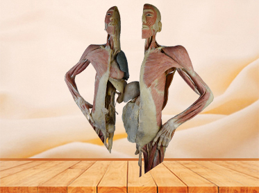 divided people plastinated specimen