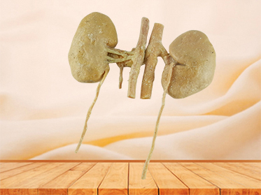 double kidney plastinated specimen