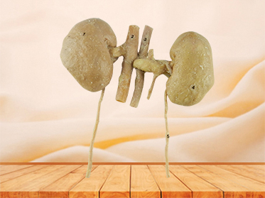 double kidney plastination