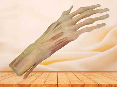 hand muscle plastination