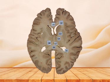 horizontal section of head plastination