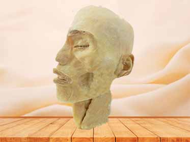 pharynx plastination