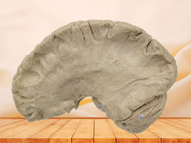internal capsule fiber plastination