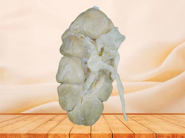 kidney of cow specimen plastination