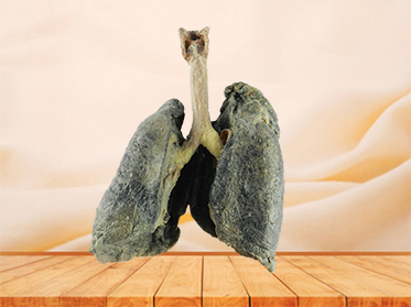lung and larynx
