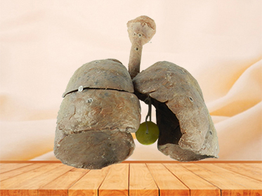 lung and larynx medical specimen