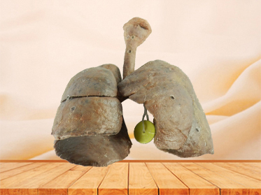 lung and larynx plastinated specimen