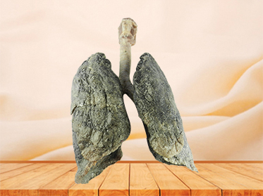 lung and larynx plastinated specimen