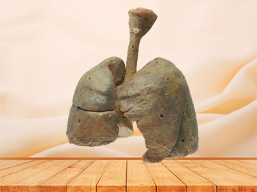 lung and larynx plastination