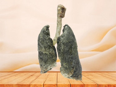 lung and larynx plastination
