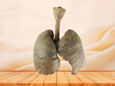 lung and larynx teaching specimen