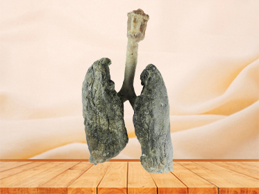 lung and larynx teaching specimen
