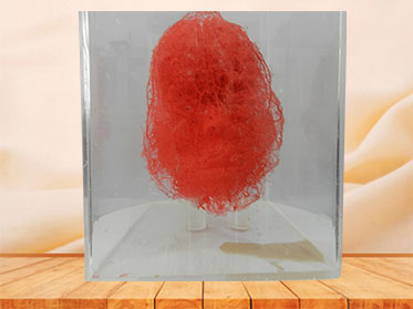 medical artery of head and neck casting specimen