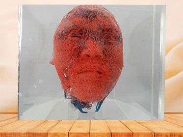 medical blood vessels of head and neck casting specimen