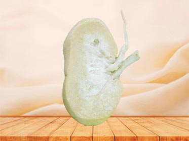 medical coronal section of pig kidney teaching specimen