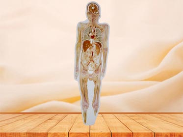 medical coronal section of whole body embedded specimen