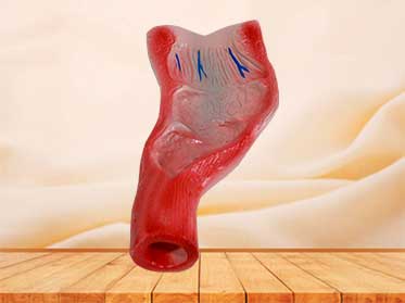 medical rectum cavity model