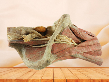 medical sagittal section of female pelvis with uterus vessels