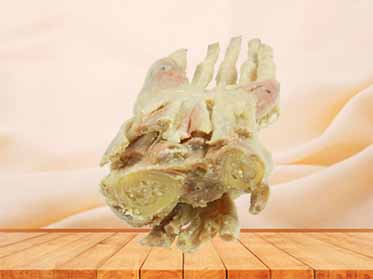 middle muscle of human hand plastination