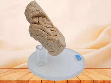 paracele plastination