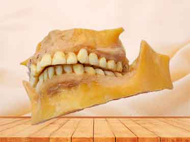 permanent teeth plastinated specimen